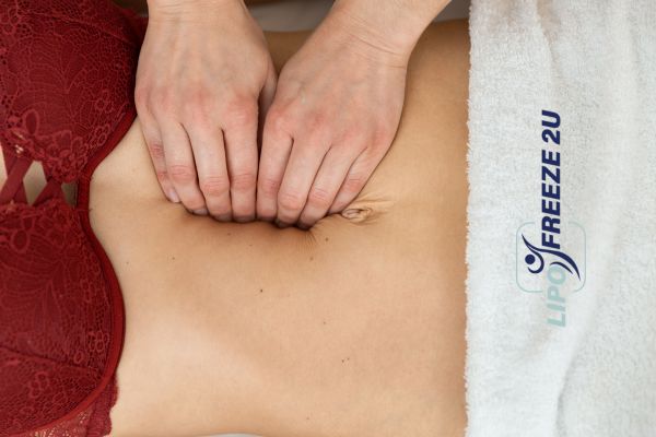 diastasis recti treatment Sunbury