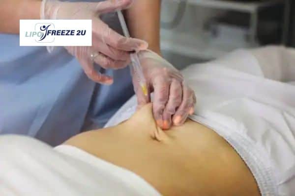 How Does Aqualyx Fat Dissolving Injection Work to Break Down Fat Sunbury?