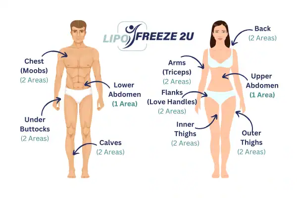 Areas you can have fat freezing treatment Sunbury
